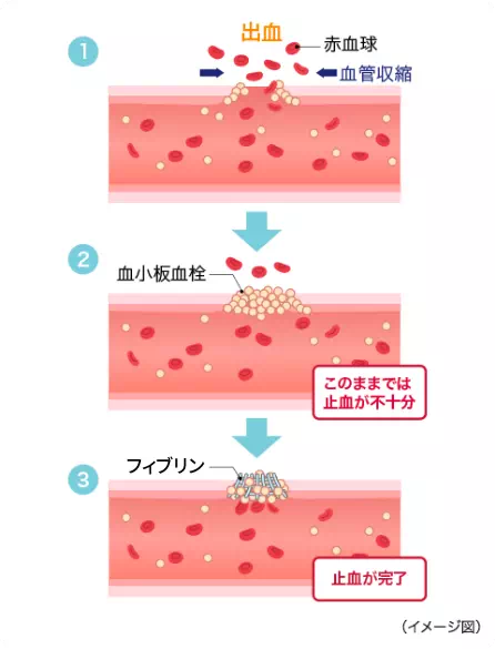 イメージ図