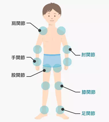 【図2】血友病性関節症の好発部位