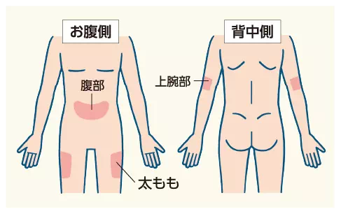 イメージ図:お腹側(腹部・太もも)、背中側(上腕部)