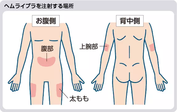 イメージ図