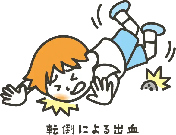 説明イラスト:転倒による出血