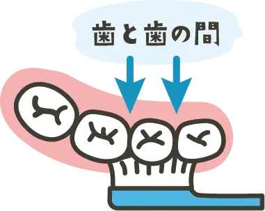 説明イラスト:歯と歯の間