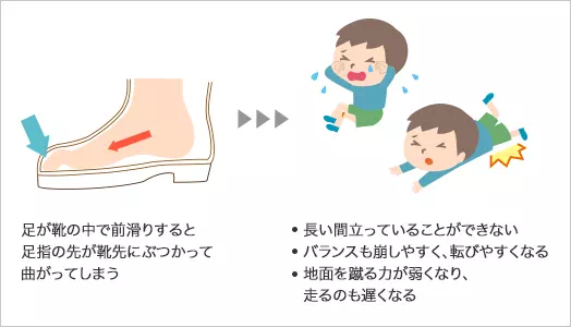 図：大きすぎる靴を履くことでの不具合