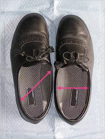 図:靴の変形とその原因